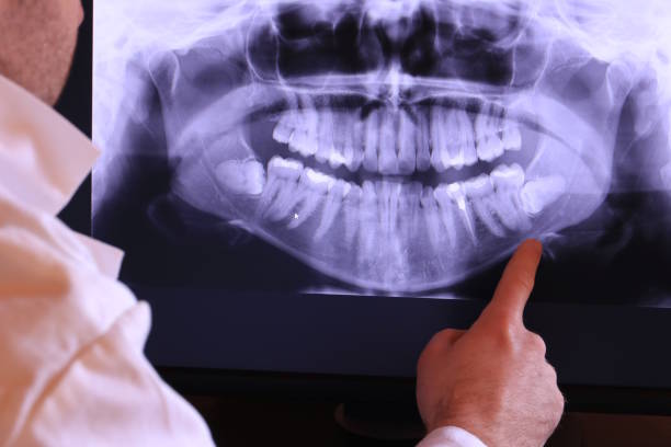 Best Root Canal Emergency Dentist  in Tioga, TX