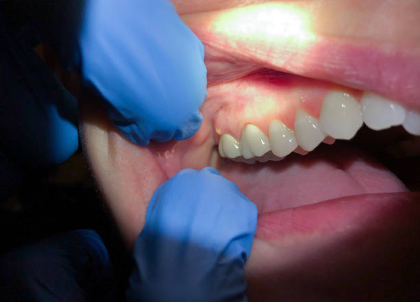 Best Emergency Gum Pain Relief  in Tioga, TX